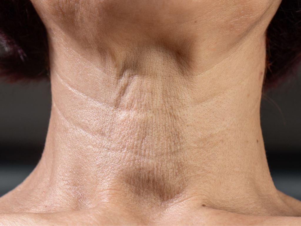Mature woman’s neck with fine lines and changes in skin texture