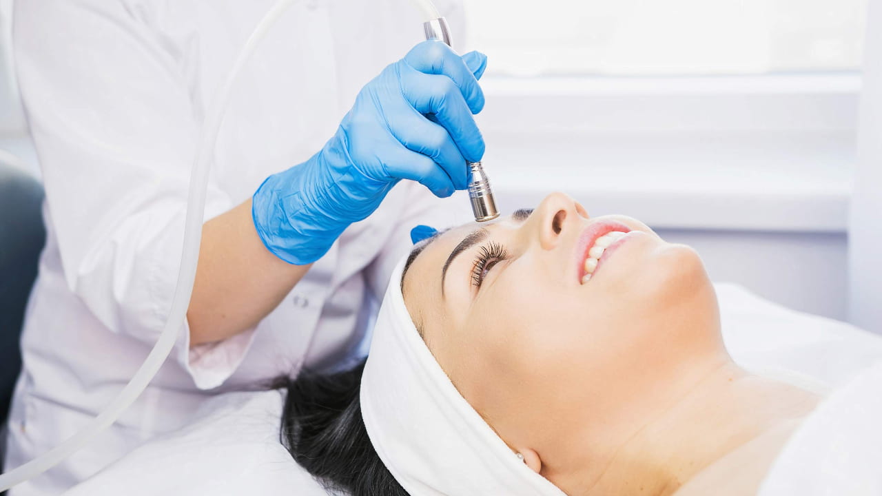Τι είναι Microneedling – Κάντο όπως η Angelina Jolie