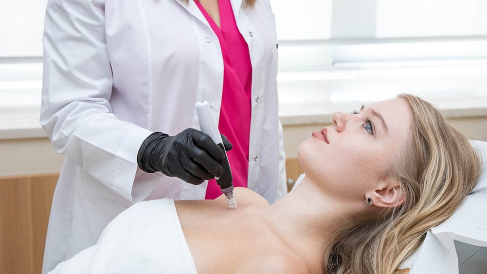 Microneedling treatment on the neck and décolleté.
